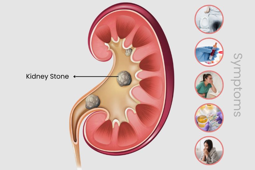 Male Infertility: Causes, Symptoms, Tests & Treatment Options