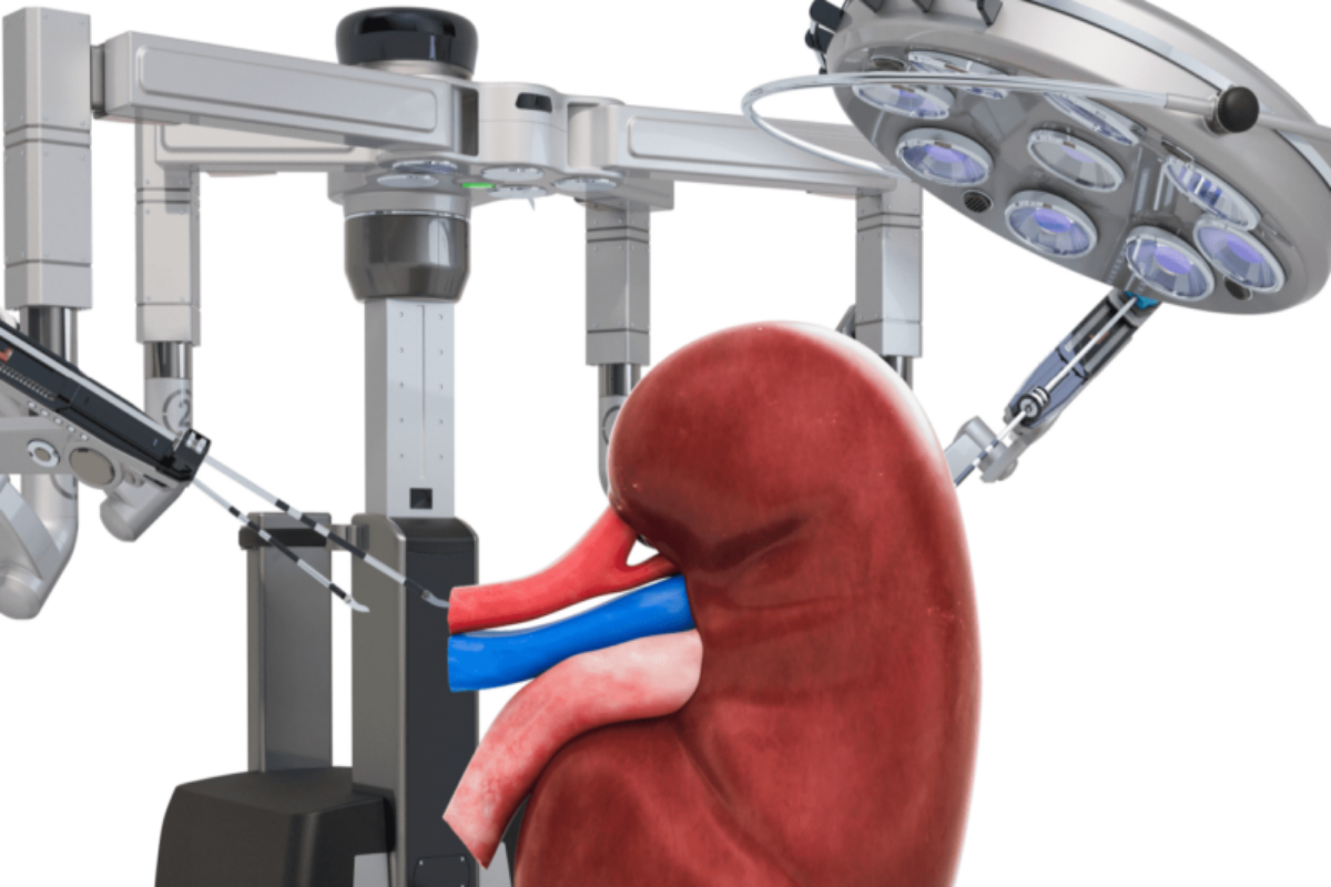 Robotic Surgery in Urology: Everything You Should Know